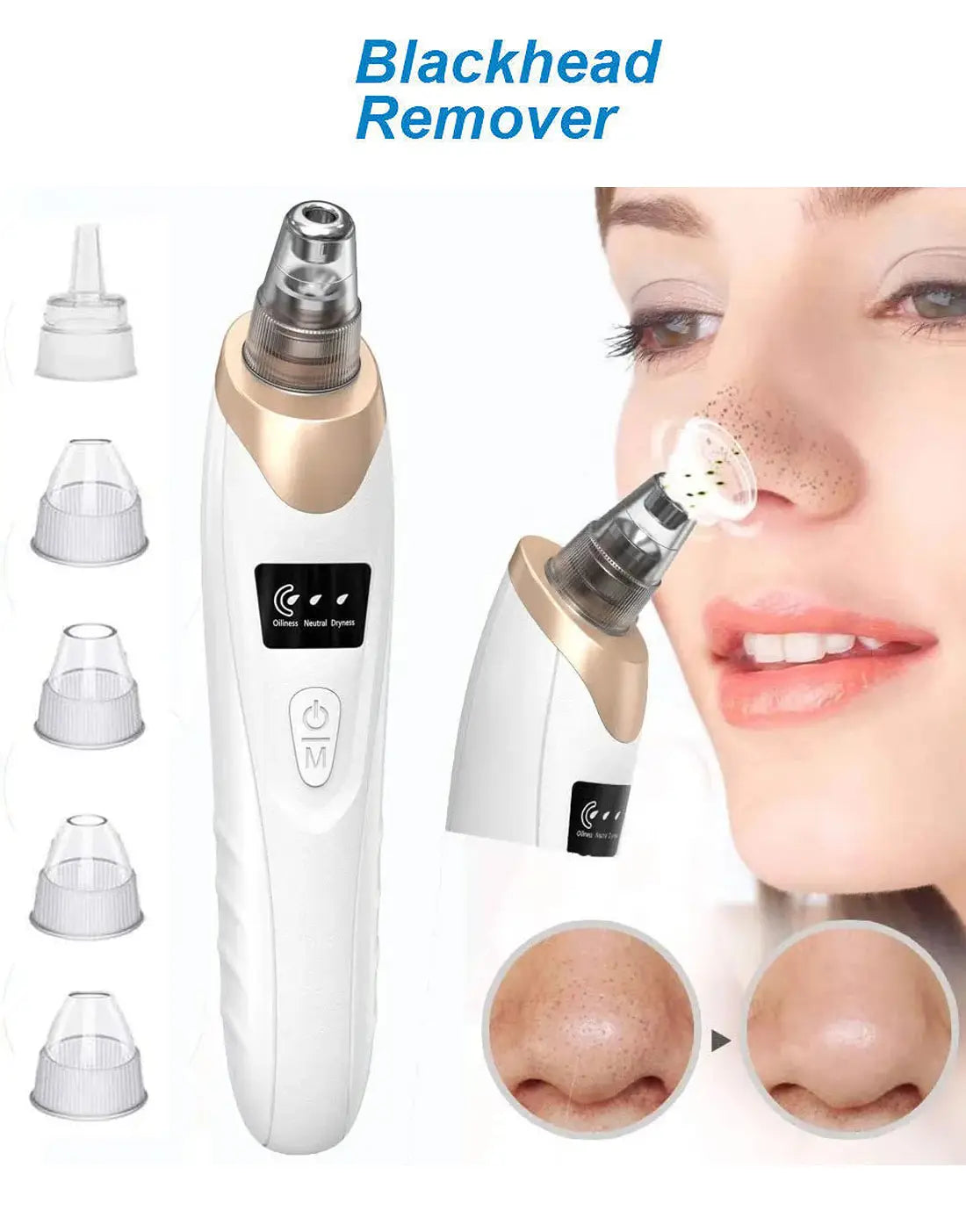 5-in-1 Blackhead Remover Rechargeable