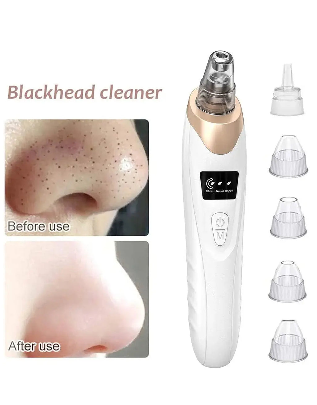 5-in-1 Blackhead Remover Rechargeable